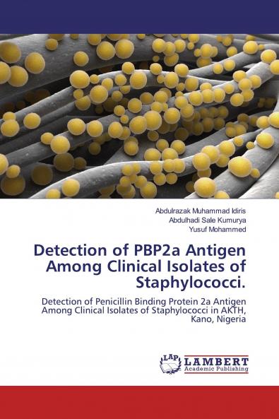 Detection of PBP2a Antigen Among Clinical Isolates of Staphylococci.