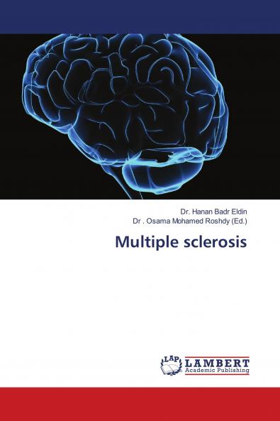 Multiple sclerosis