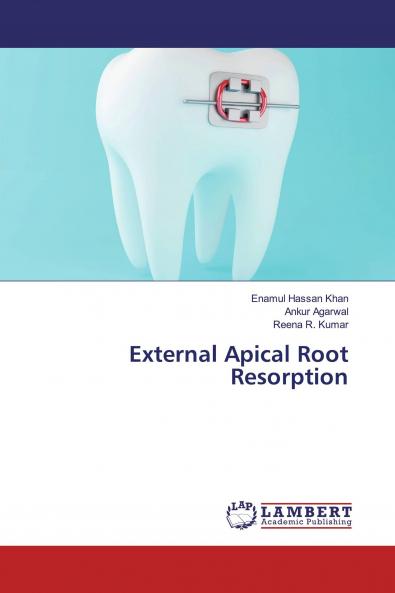 External Apical Root Resorption