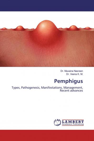 Pemphigus
