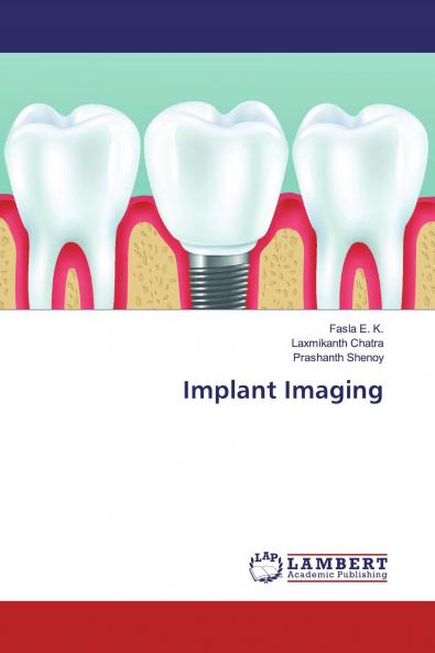 Implant Imaging