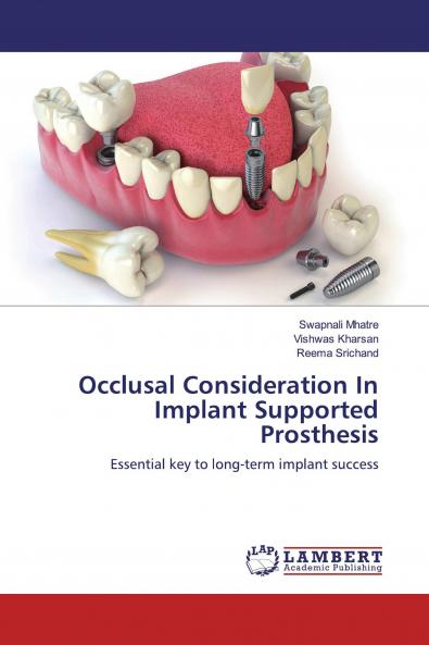 Occlusal Consideration In Implant Supported Prosthesis