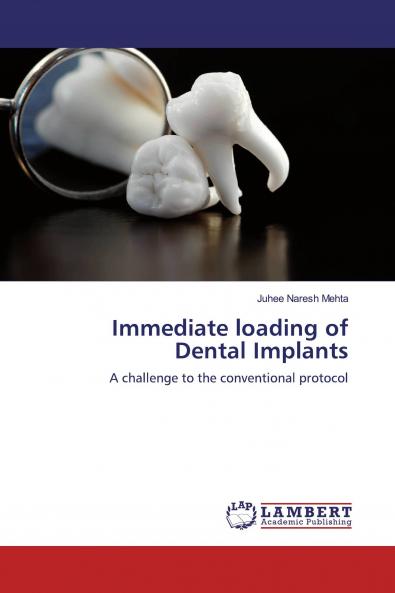Immediate loading of Dental Implants