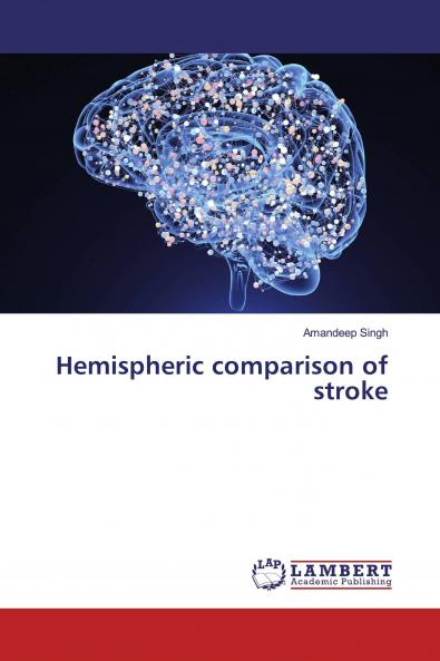 Hemispheric comparison of stroke