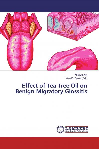 Effect of Tea Tree Oil on Benign Migratory Glossitis