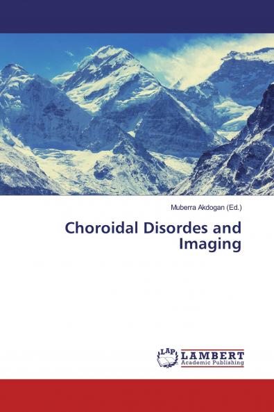Choroidal Disordes and Imaging