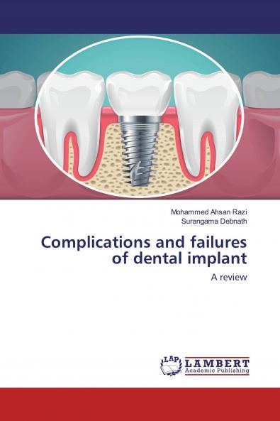 Complications and failures of dental implant