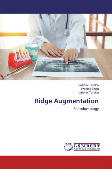 Ridge Augmentation