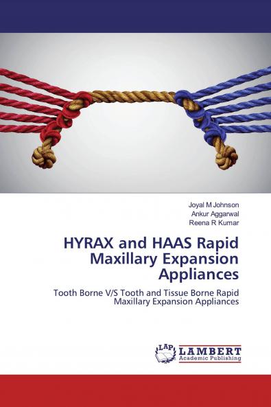 HYRAX and HAAS Rapid Maxillary Expansion Appliances