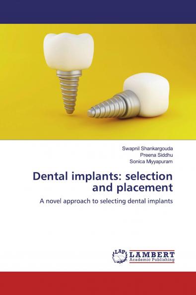 Dental implants