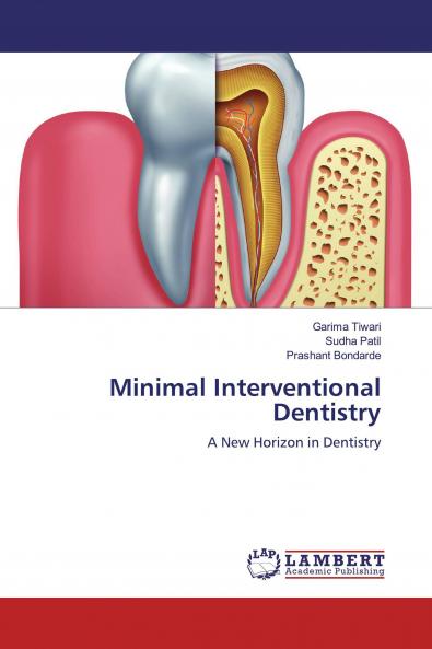 Minimal Interventional Dentistry