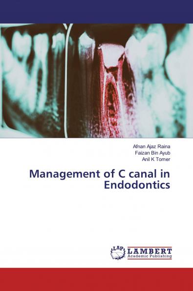 Management of C canal in Endodontics