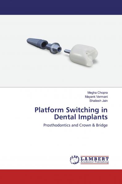 Platform Switching in Dental Implants