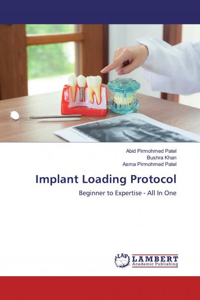 Implant Loading Protocol