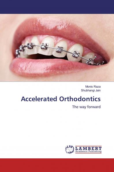 Accelerated Orthodontics