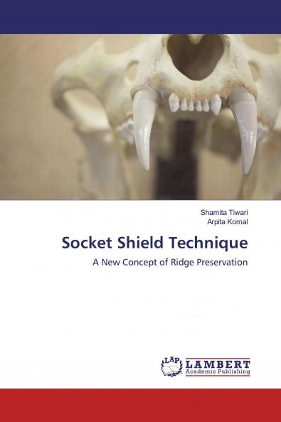 Socket Shield Technique