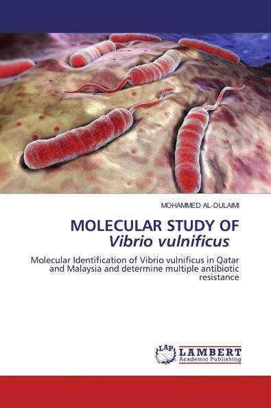 MOLECULAR STUDY OF Vibrio vulnificus