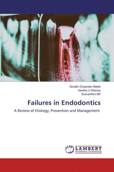Failures in Endodontics