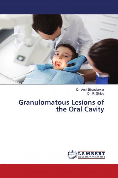 Granulomatous Lesions of the Oral Cavity
