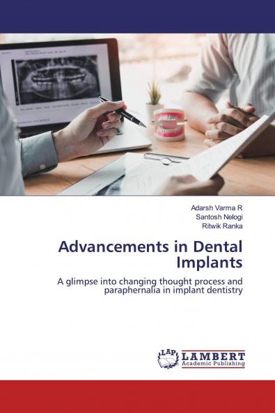 Advancements in Dental Implants