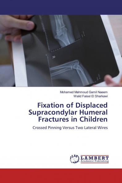 Fixation of Displaced Supracondylar Humeral Fractures in Children