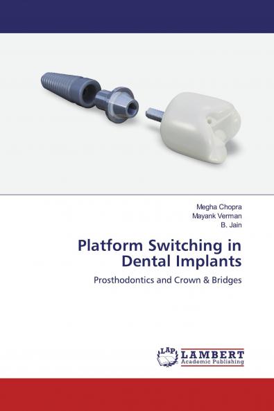 Platform Switching in Dental Implants