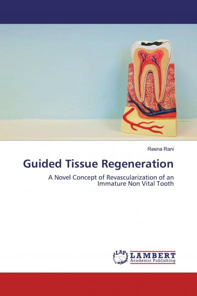 Guided Tissue Regeneration