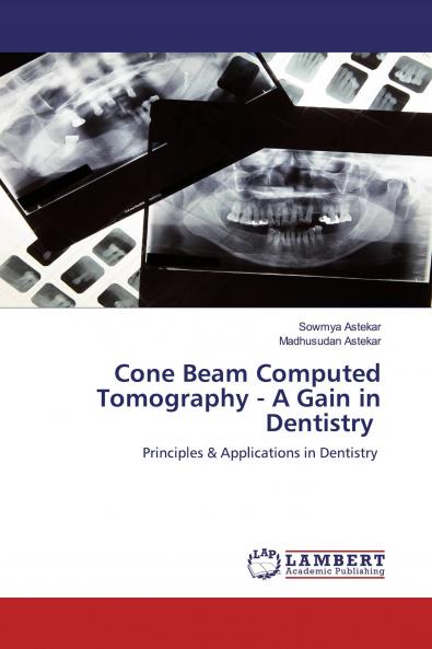 Cone Beam Computed Tomography - A Gain in Dentistry