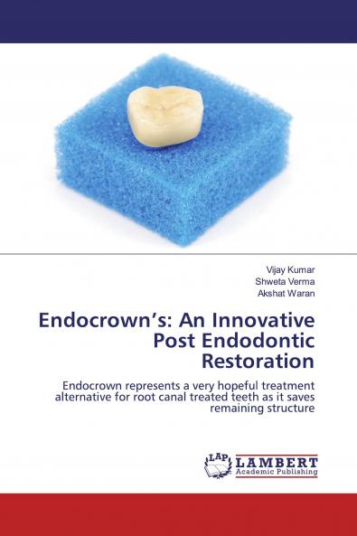 Endocrown���s: An Innovative Post Endodontic Restoration