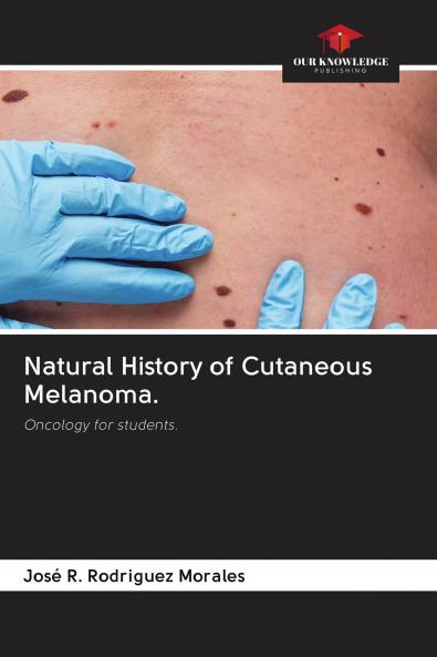 Natural History of Cutaneous Melanoma.