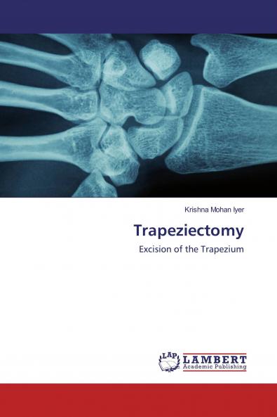 Trapeziectomy