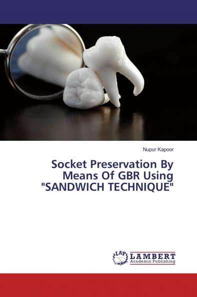 Socket Preservation By Means Of GBR Using SANDWICH TECHNIQUE
