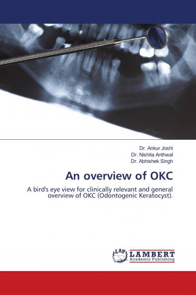 An overview of OKC