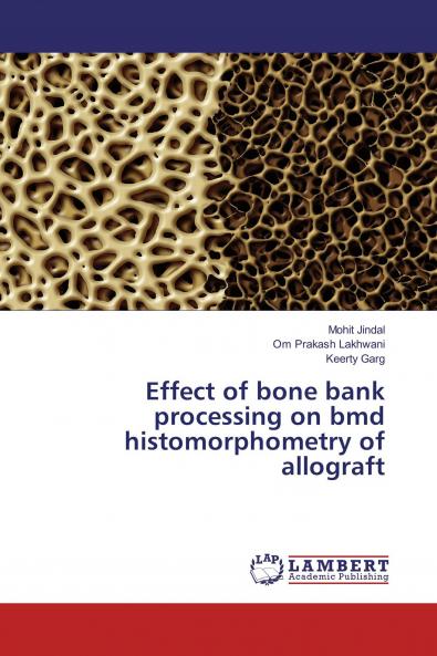 Effect of bone bank processing on bmd histomorphometry of allograft
