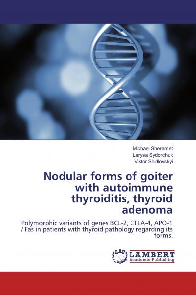 Nodular forms of goiter with autoimmune thyroiditis thyroid adenoma