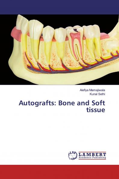 Autografts: Bone and Soft tissue
