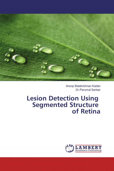 Lesion Detection Using Segmented Structure of Retina