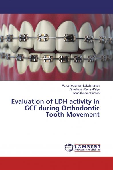 Evaluation of LDH activity in GCF during Orthodontic Tooth Movement