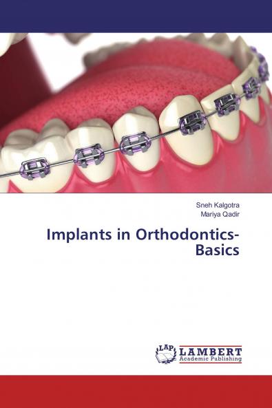 Implants in Orthodontics- Basics