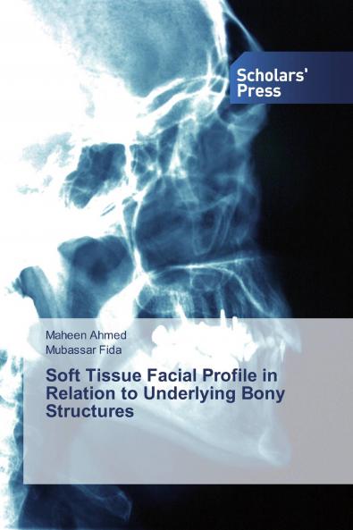 Soft Tissue Facial Profile in Relation to Underlying Bony Structures