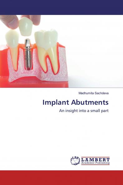 Implant Abutments