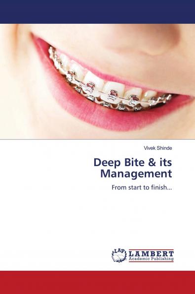 Deep Bite & its Management