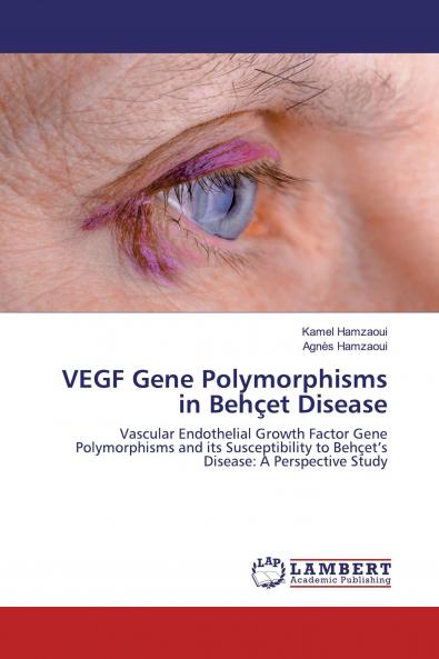 VEGF Gene Polymorphisms in Beh��et Disease
