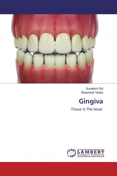 Gingiva