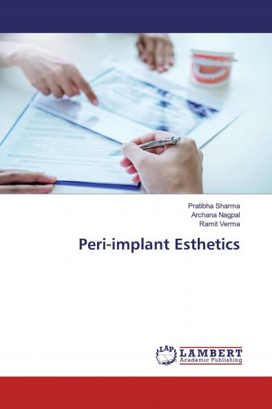 Peri-implant Esthetics