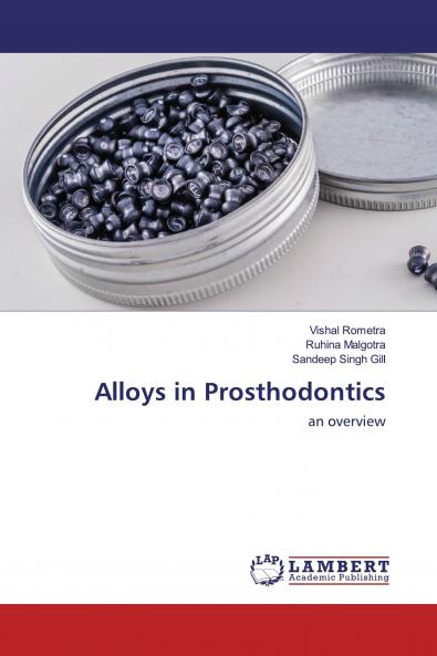 Alloys in Prosthodontics
