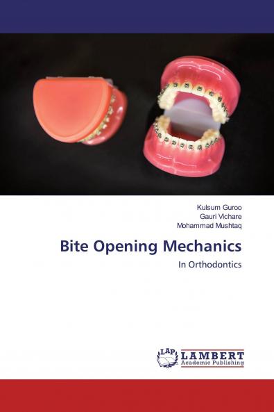 Bite Opening Mechanics
