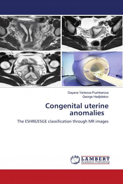 Congenital uterine anomalies