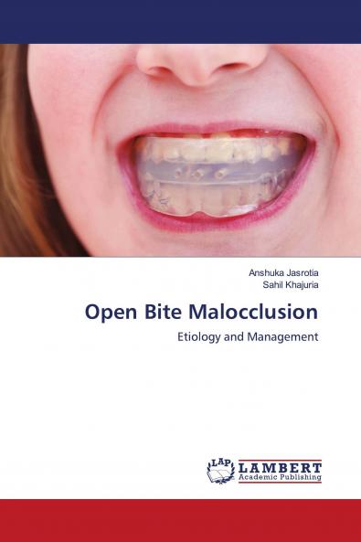 Open Bite Malocclusion