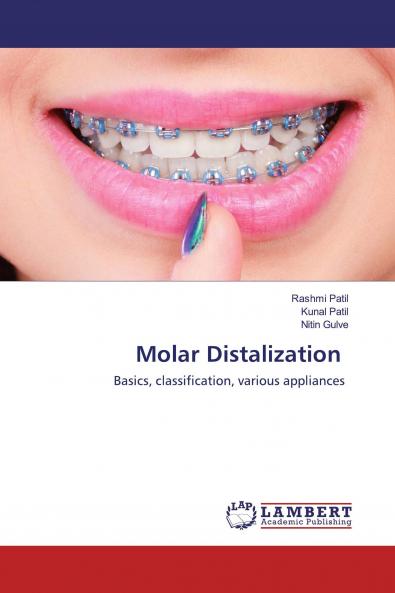 Molar Distalization